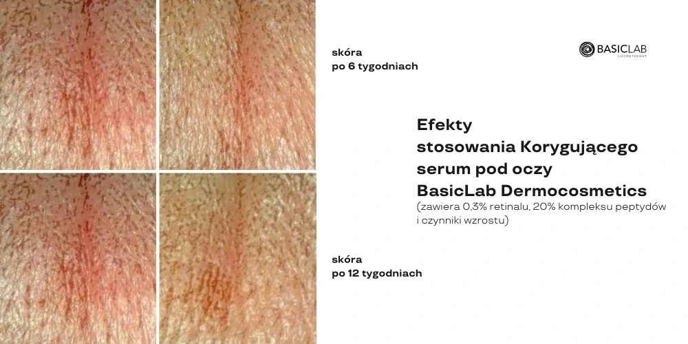 najlepsze serum pod oczy efekty