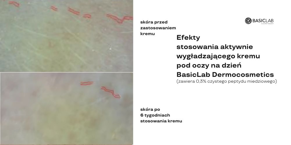 najlepsze kosmetyki na zmarzszczki efekty