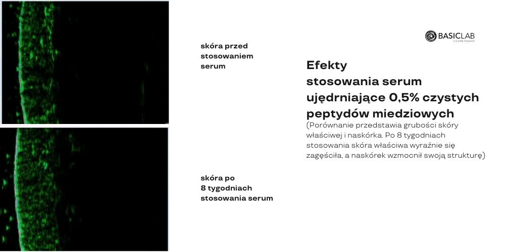 peptydy miedziowe efekty na skórze
