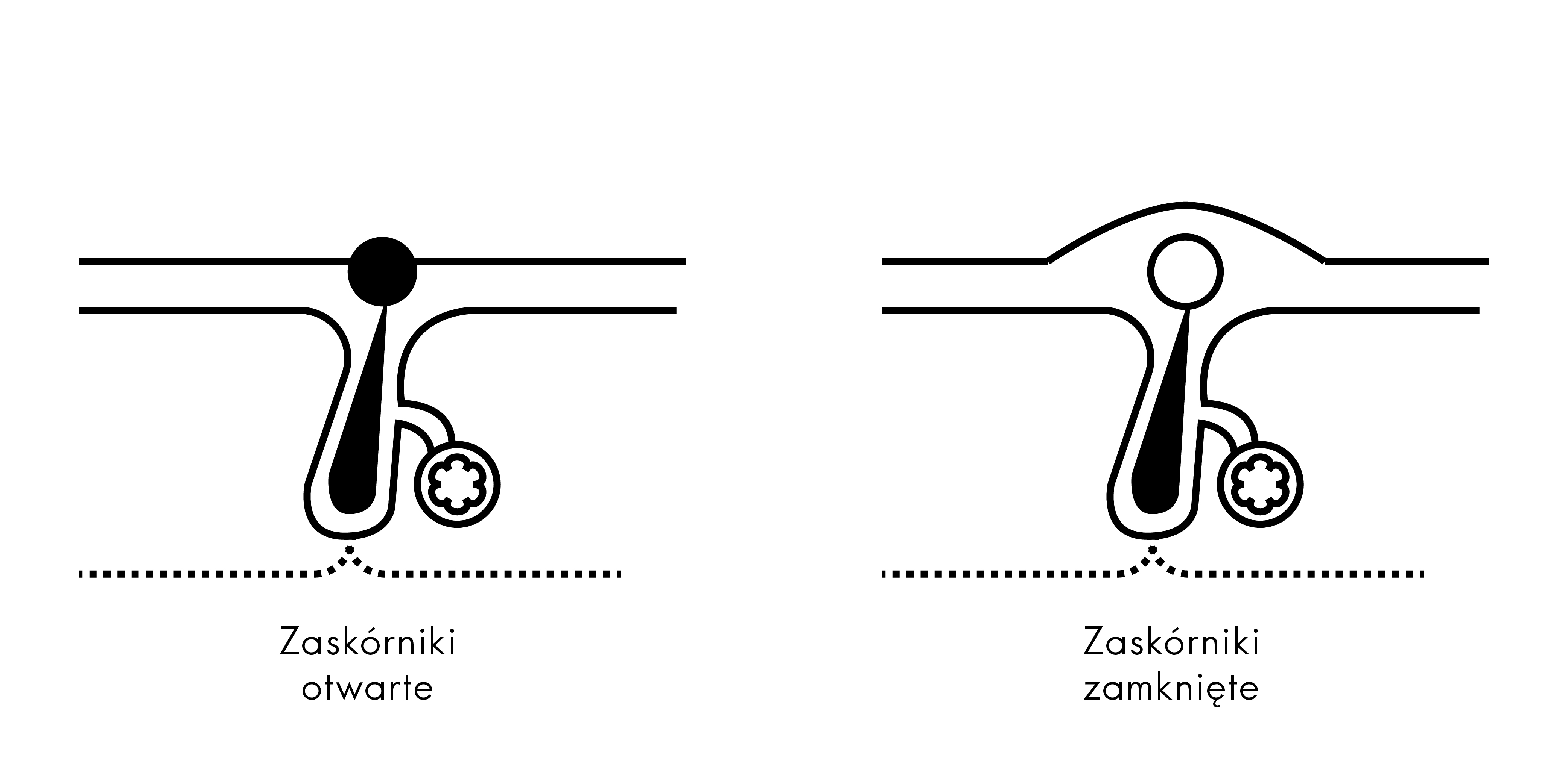 zaskorniki otwarte zamkniete