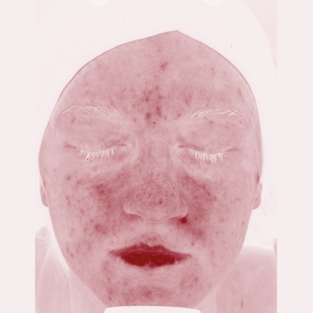 Po